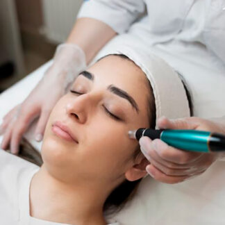 Limpieza Facial con Punta de Diamante