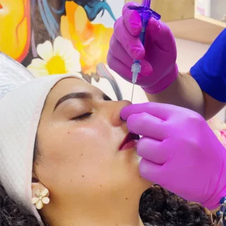 Armonizacion Facial con Acido Hialurónico