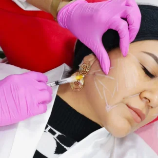 Bioestimuladores de colágeno