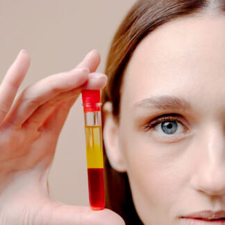 Plasma + Dermapen + Vitaminas