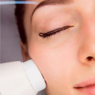 Radiofrecuencia Facial