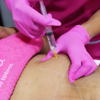 Hidrolipoclasia