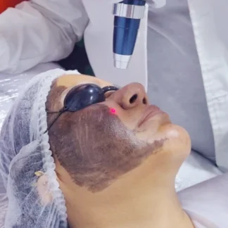 Hollywood Peel Diva Star